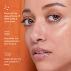 UNSPOTTED 4X® Acid Jelly Night Serum