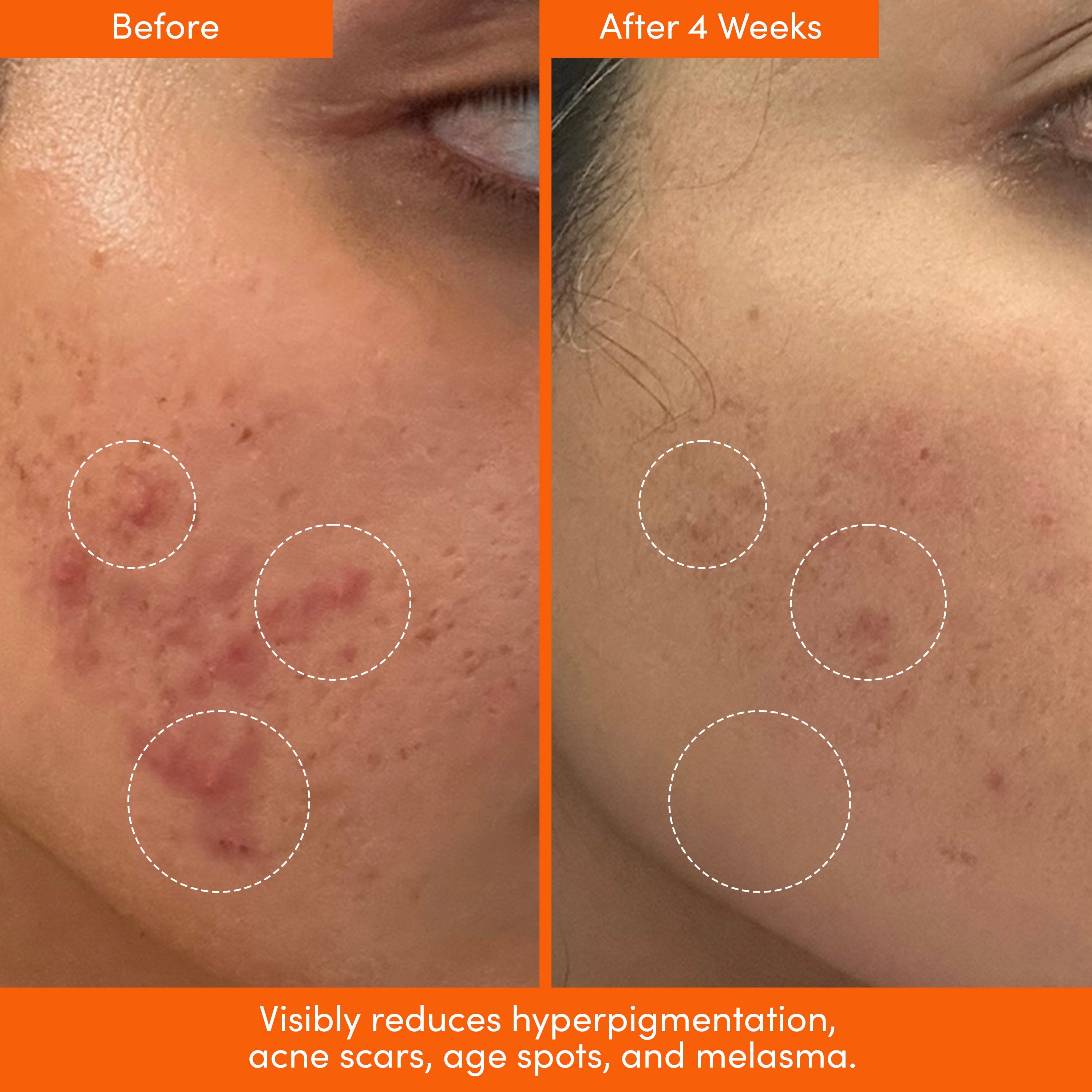 MANE SQUEEZE Tinted SPF Sunscreen + Dark Spot Serum Bundle