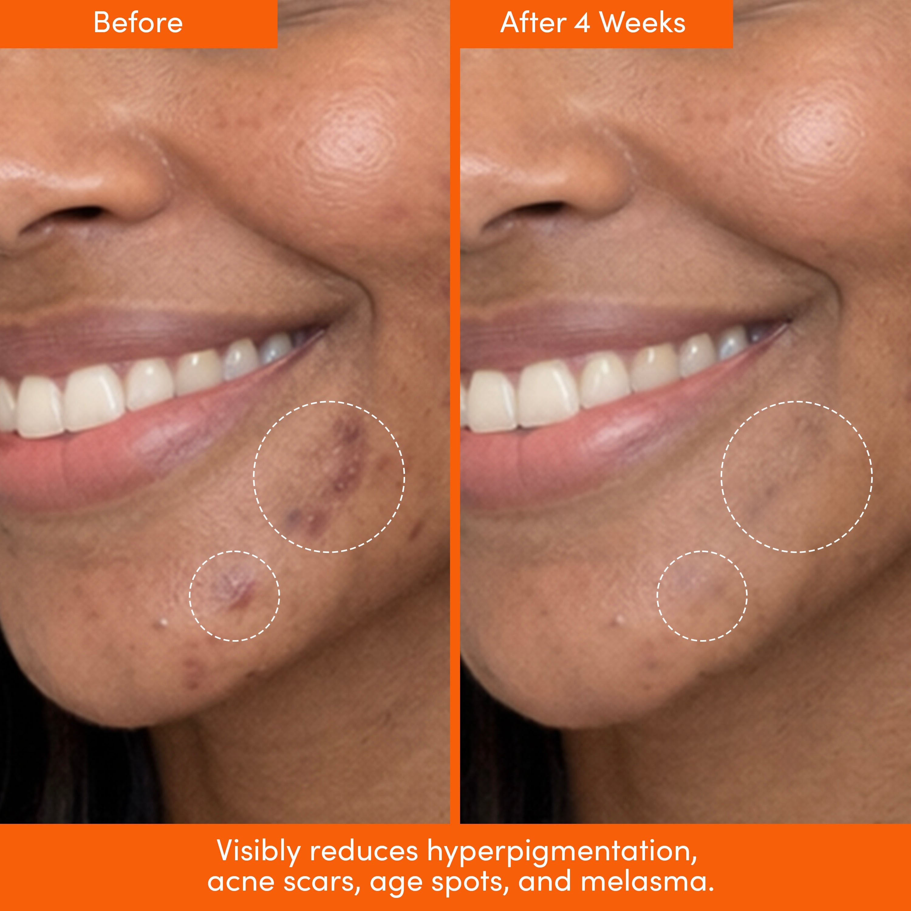 MANE SQUEEZE Tinted SPF Sunscreen + Dark Spot Serum Bundle