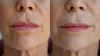 Ageless Lip & Line Filler - WONDERWALL