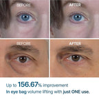 Eyephalt Eyebag Cream
