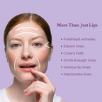 Ageless Lip & Line Filler - WONDERWALL