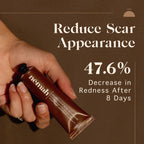 Renewing Scar Cream - WONDERWALL