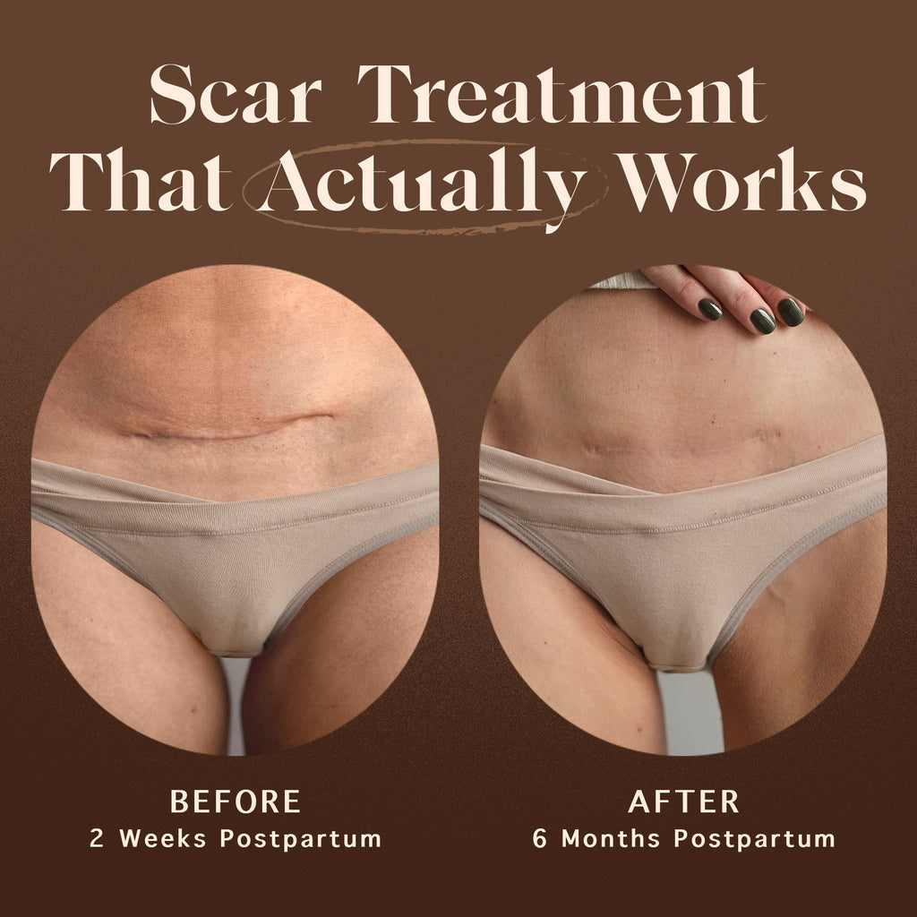 Renewing Scar Cream