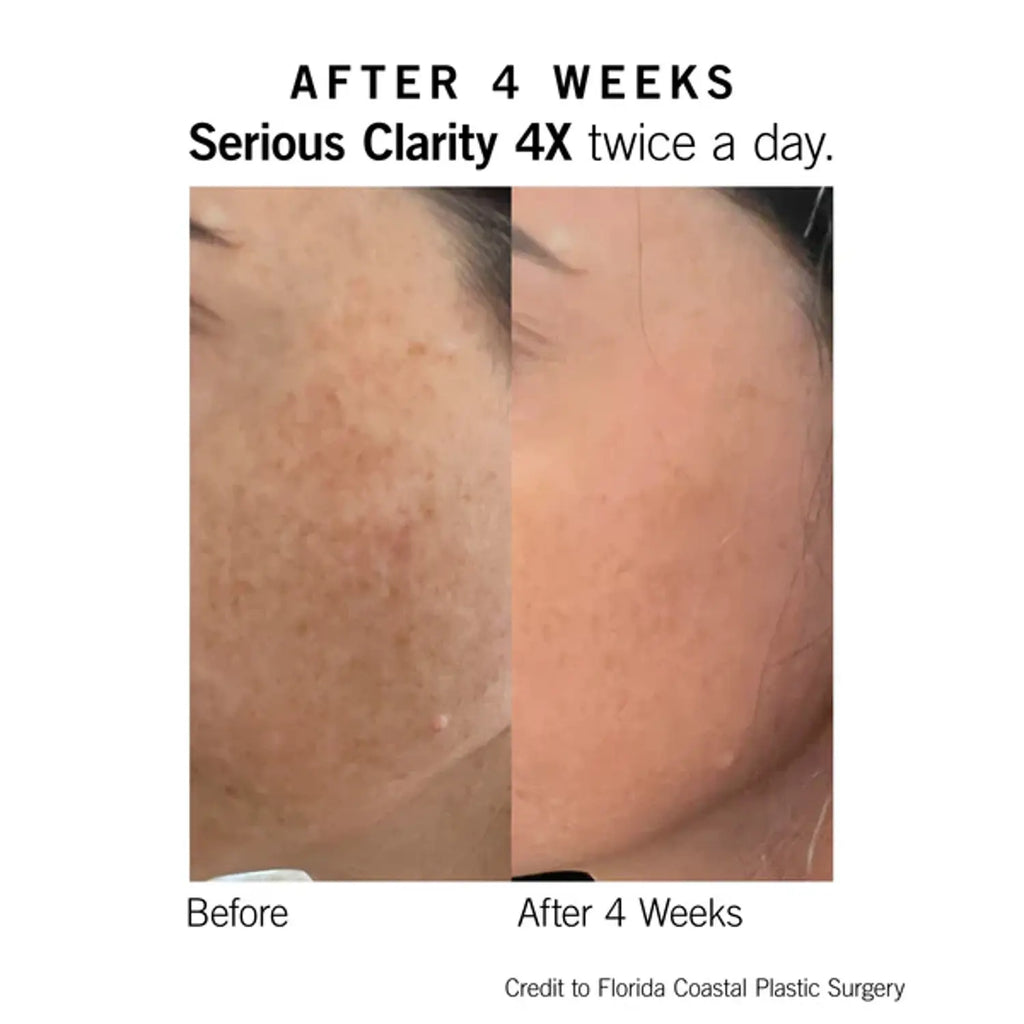 Serious Clarity 4X 1 Oz