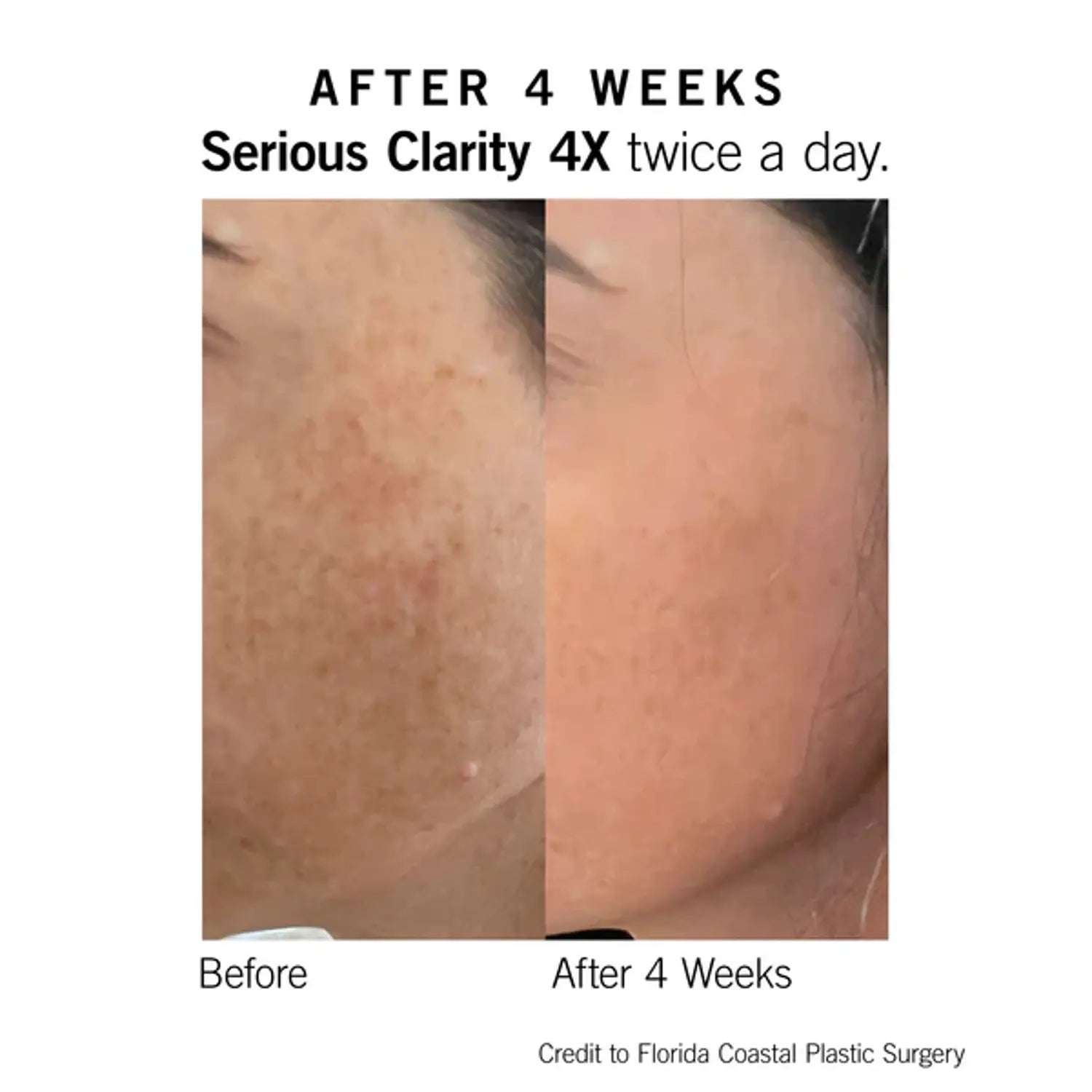 Serious Clarity 4X 1 Oz