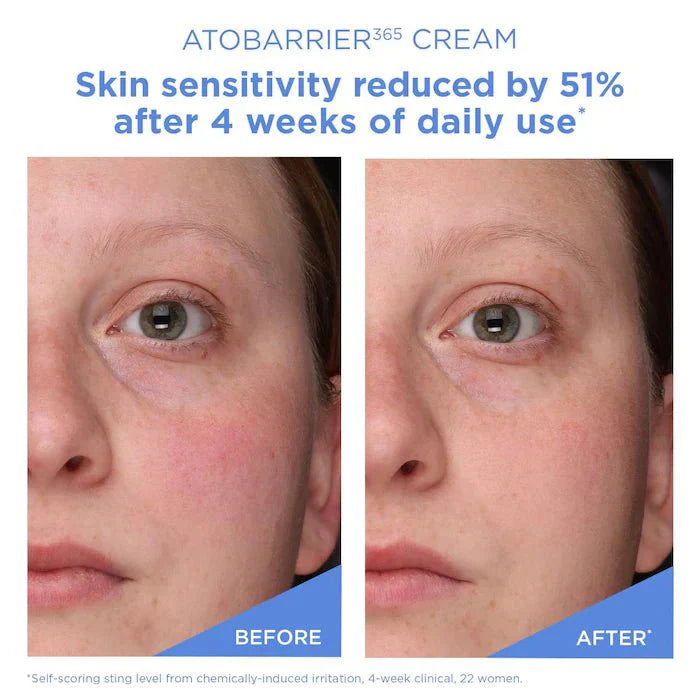 Travel Size ATOBARRIER365 Cream Moisturizer 30 ml | Ceramide Barrier Repair Cream