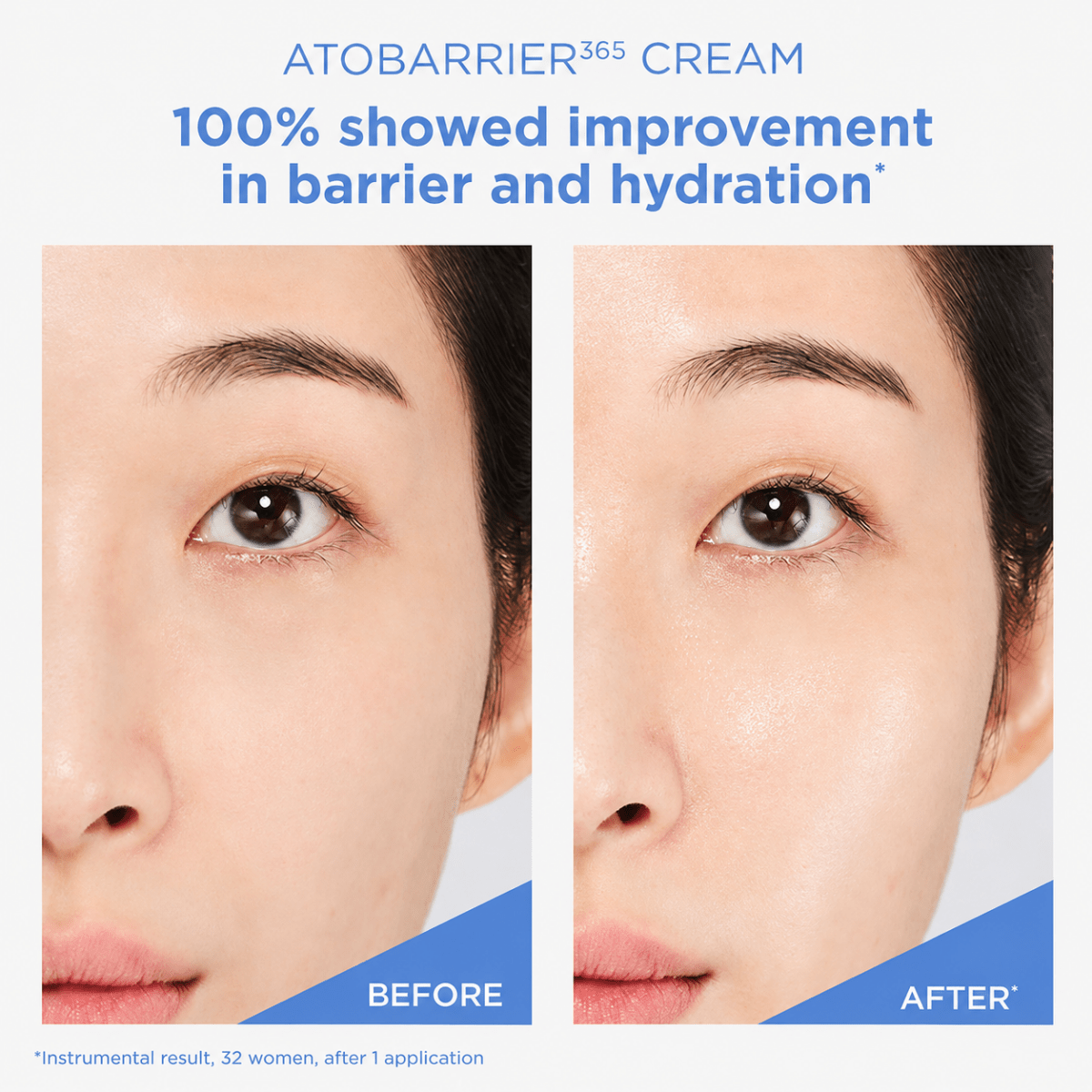 Atobarrier365 Cream