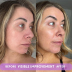 VISIBLE IMPROVEMENT