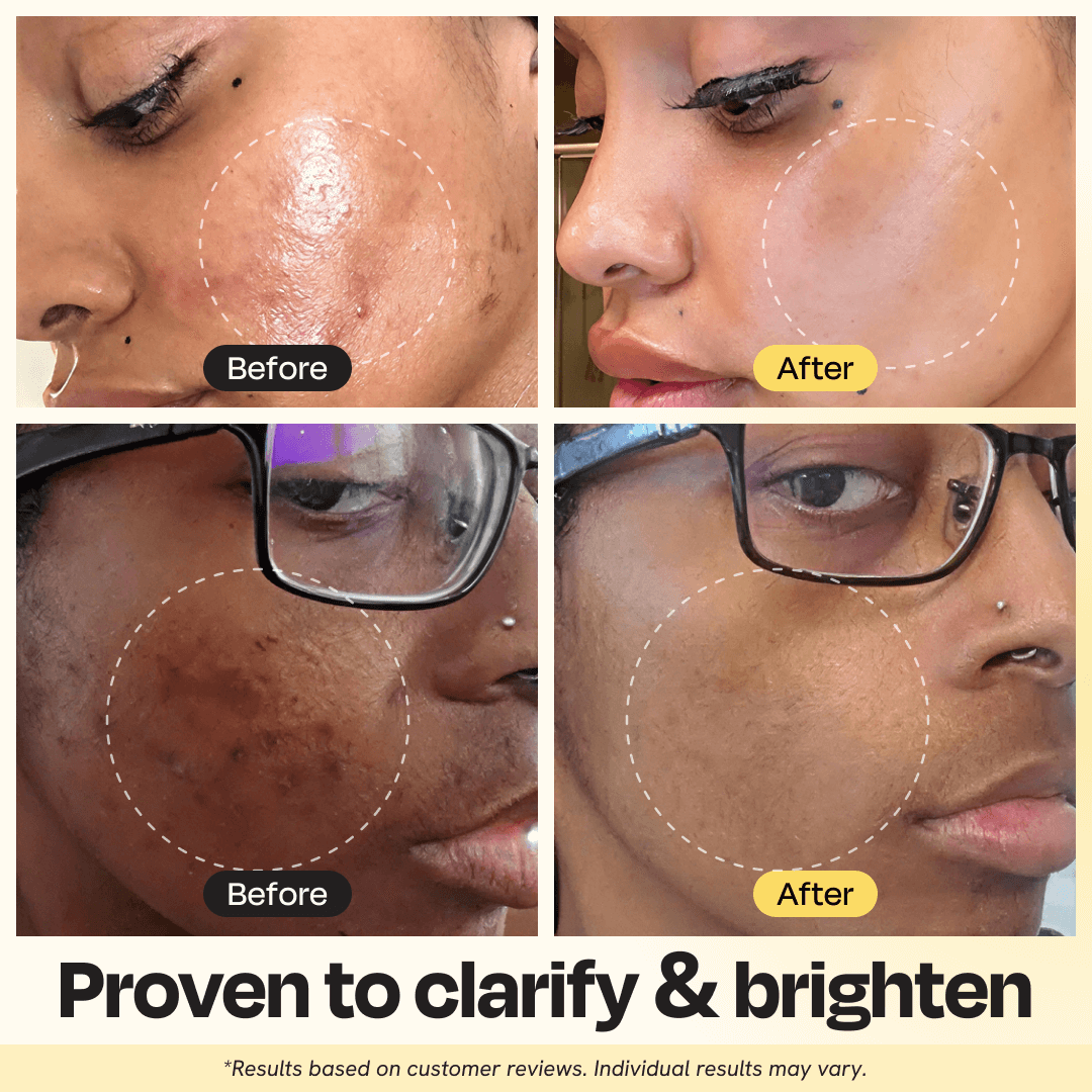 Vitamin C Clay Mask - WONDERWALL