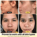 Vitamin C Clay Mask - WONDERWALL