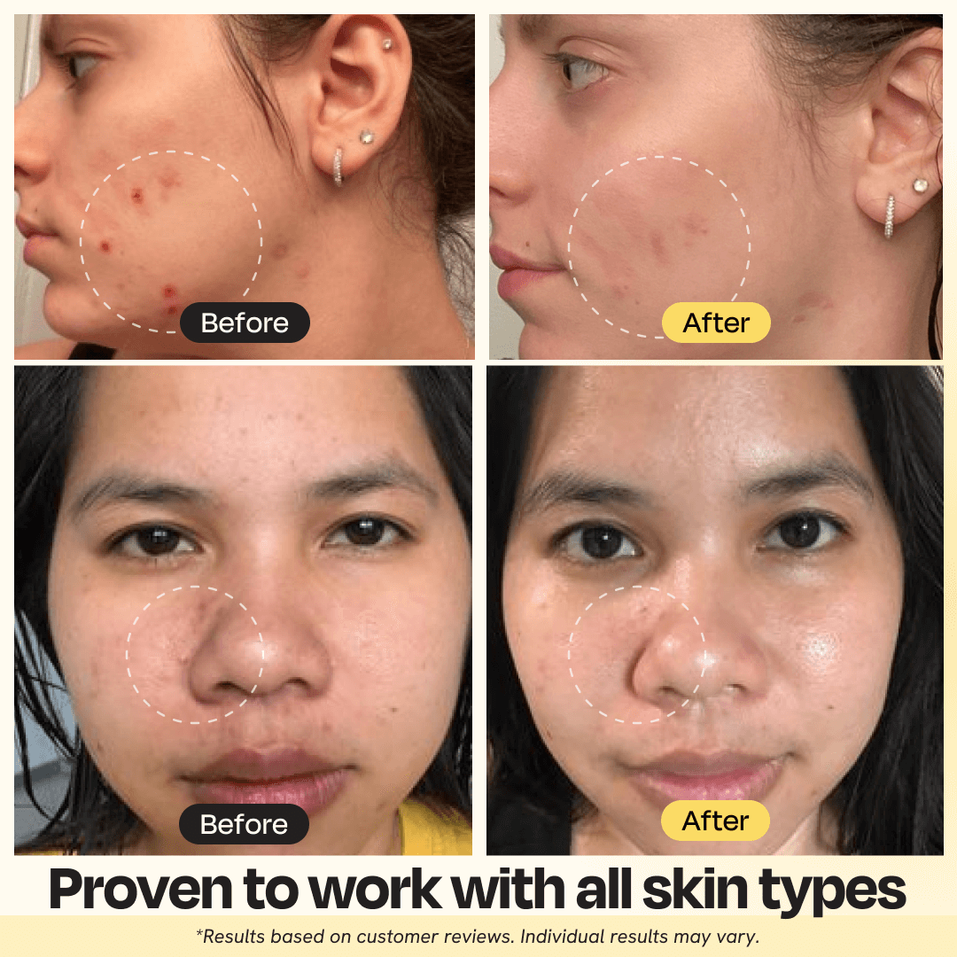 Vitamin C Clay Mask - WONDERWALL