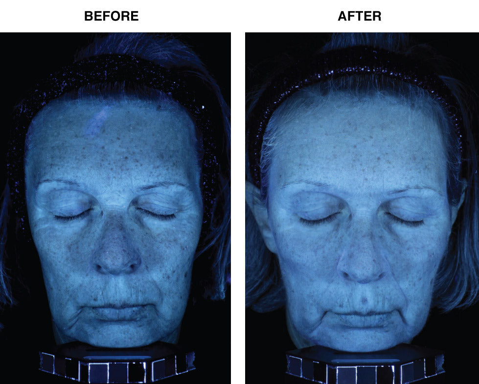 Skin Memory Serum - WONDERWALL
