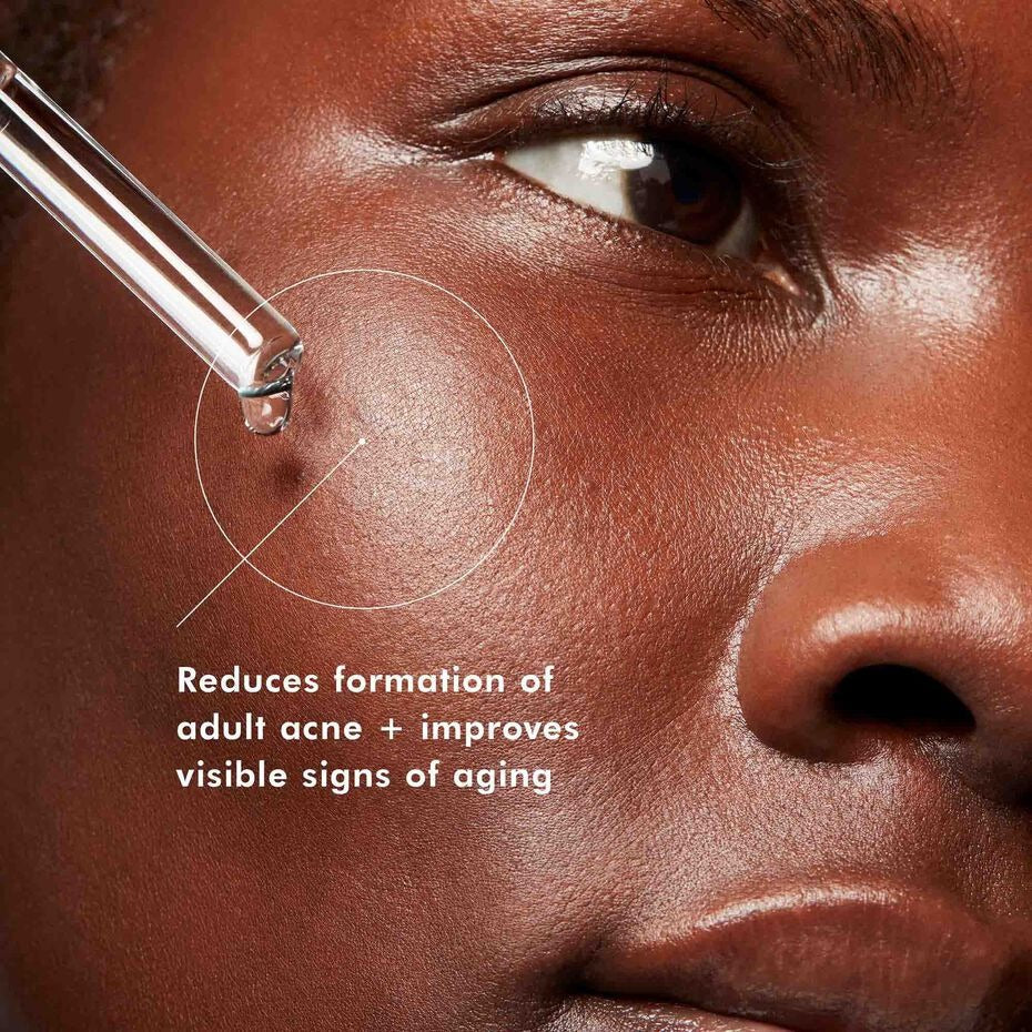 BLEMISH + AGE DEFENSE 1 fl oz