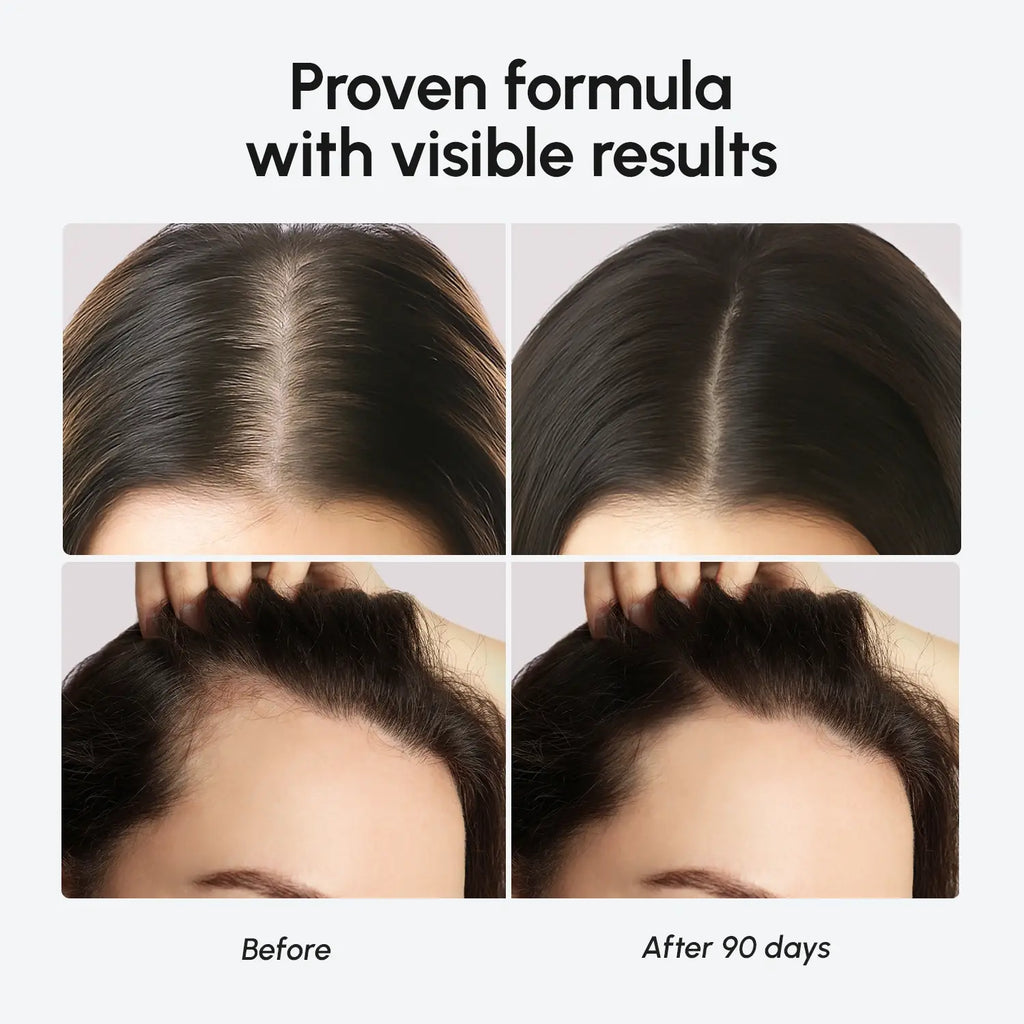 Biotin & Collagen Hair Growth Complex - WONDERWALL