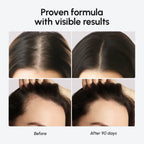 Biotin & Collagen Hair Growth Complex - WONDERWALL