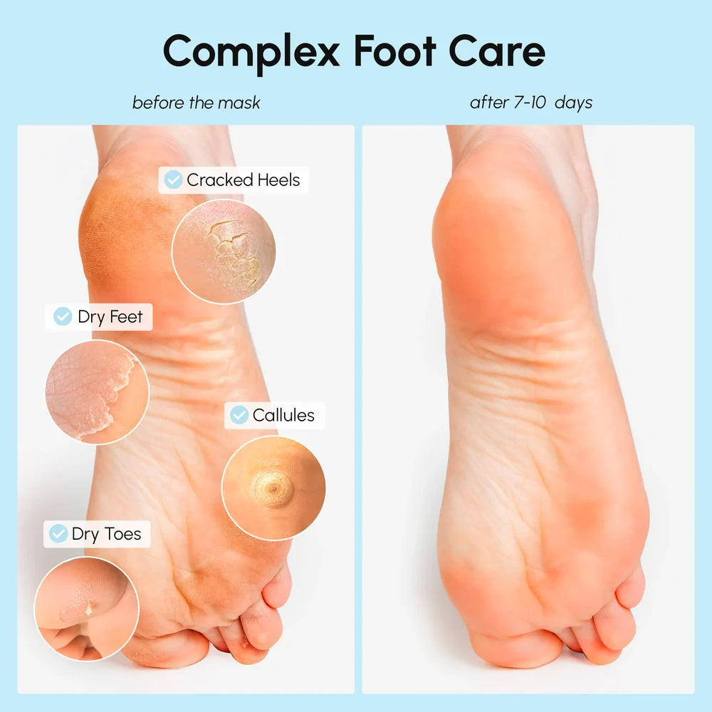 Exfoliating & Hydrating Foot Mask - WONDERWALL