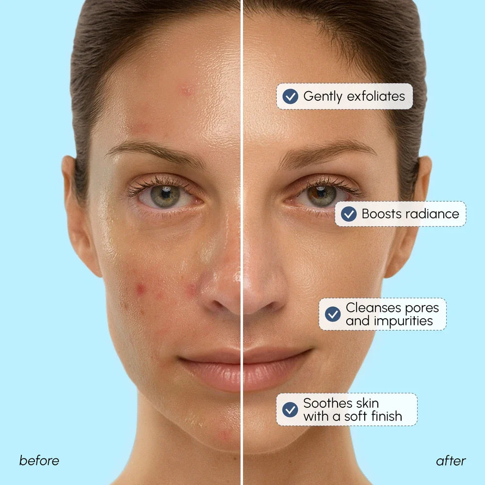 Face Polishing Scrub & Exfoliator - WONDERWALL