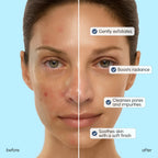 Face Polishing Scrub & Exfoliator - WONDERWALL