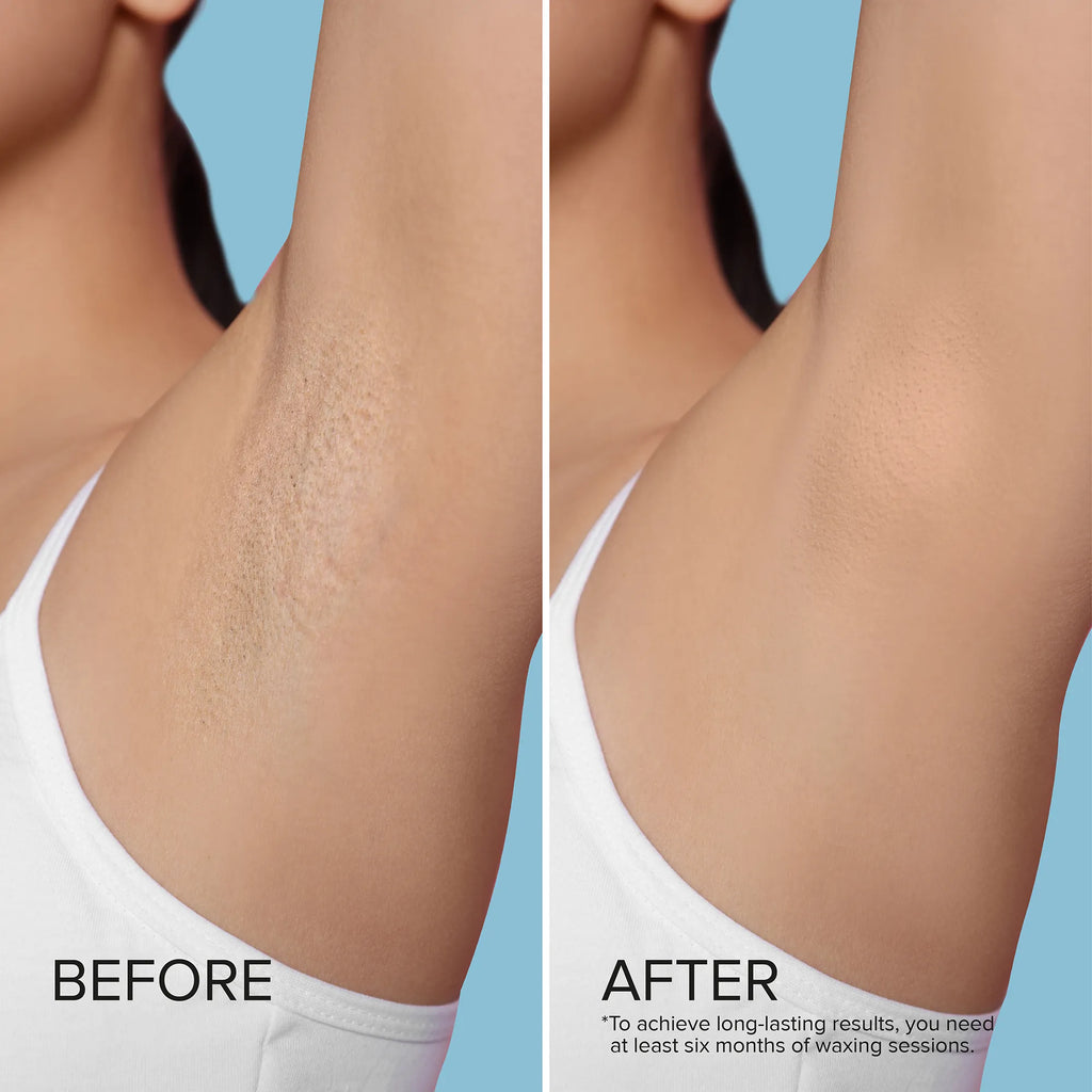 Hard Wax Beads for Hair Removal - WONDERWALL