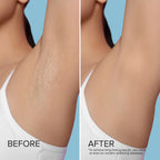 Hard Wax Beads for Hair Removal - WONDERWALL