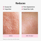 Hydrating Pore Refining Toner - WONDERWALL