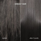 Keratin Oil Serum for Dry & Damaged Hair - WONDERWALL