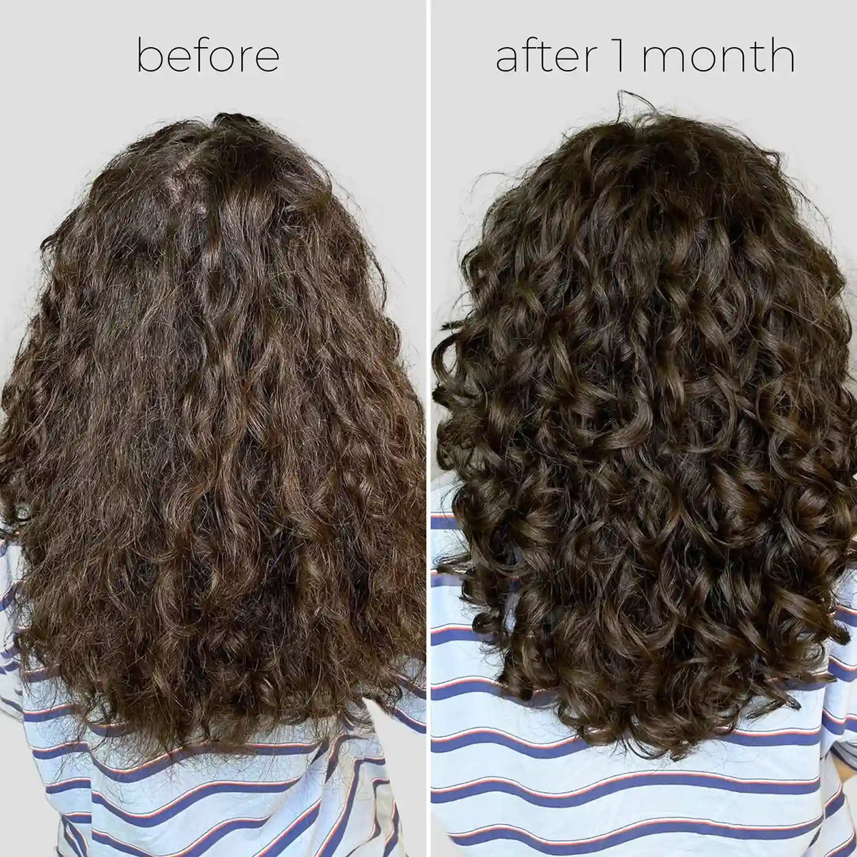 Oil Capsules For Frizzy Hair - WONDERWALL