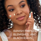 Pimple & Acne Patches - WONDERWALL