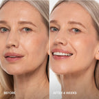 Pro-Retinol Neck Lifting Cream Massager - WONDERWALL