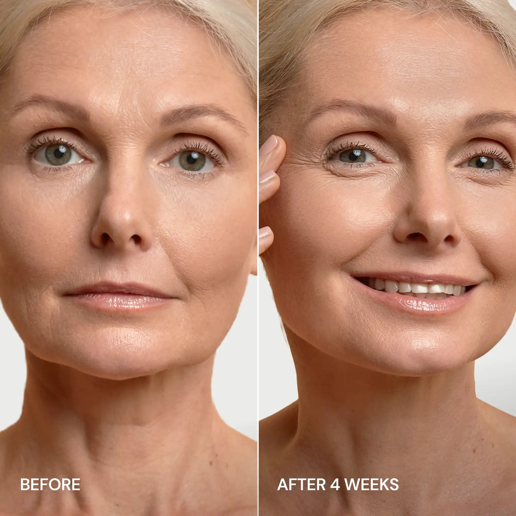 Pro-Retinol Neck Lifting Cream Massager - WONDERWALL