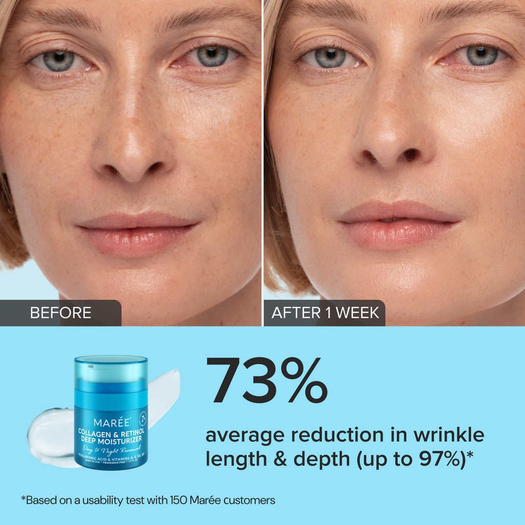 Retinol & Collagen Anti-Age Cream - WONDERWALL