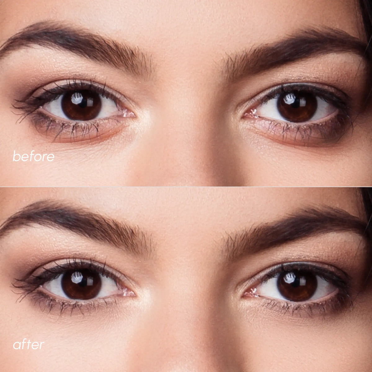 Violet Eye Patches for Dark Circles - WONDERWALL