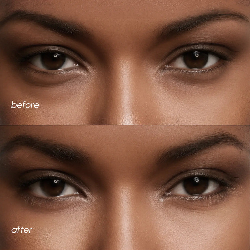 Violet Eye Patches for Dark Circles - WONDERWALL