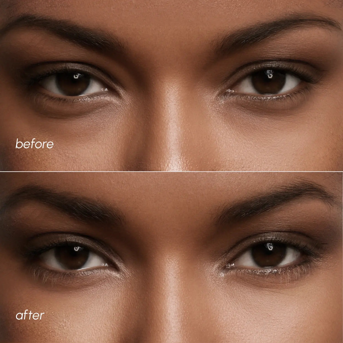 Violet Eye Patches for Dark Circles - WONDERWALL