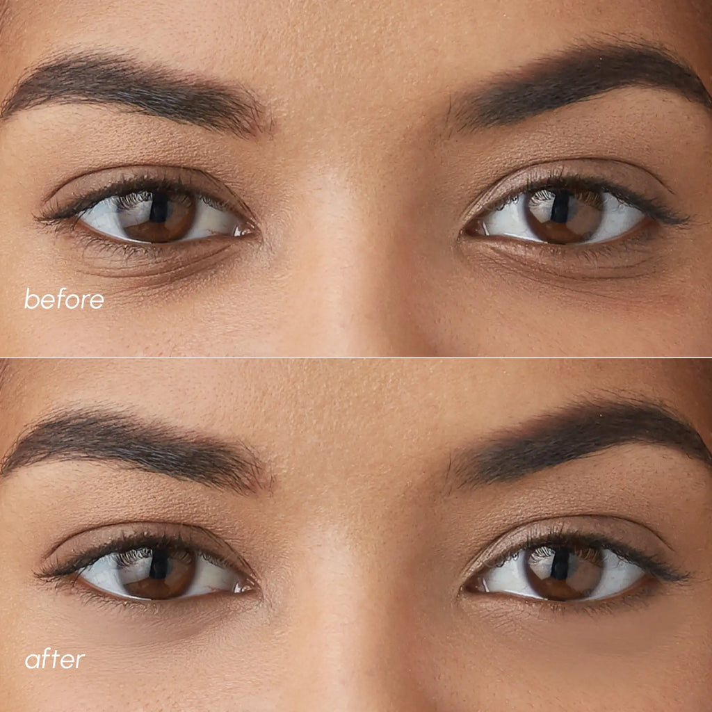 Violet Eye Patches for Dark Circles - WONDERWALL