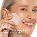 Witch Hazel Clearing Pads - WONDERWALL