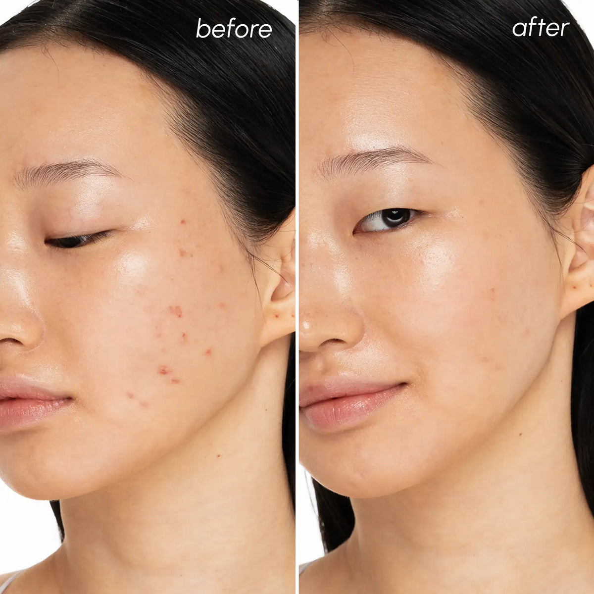 Witch Hazel Clearing Pads - WONDERWALL