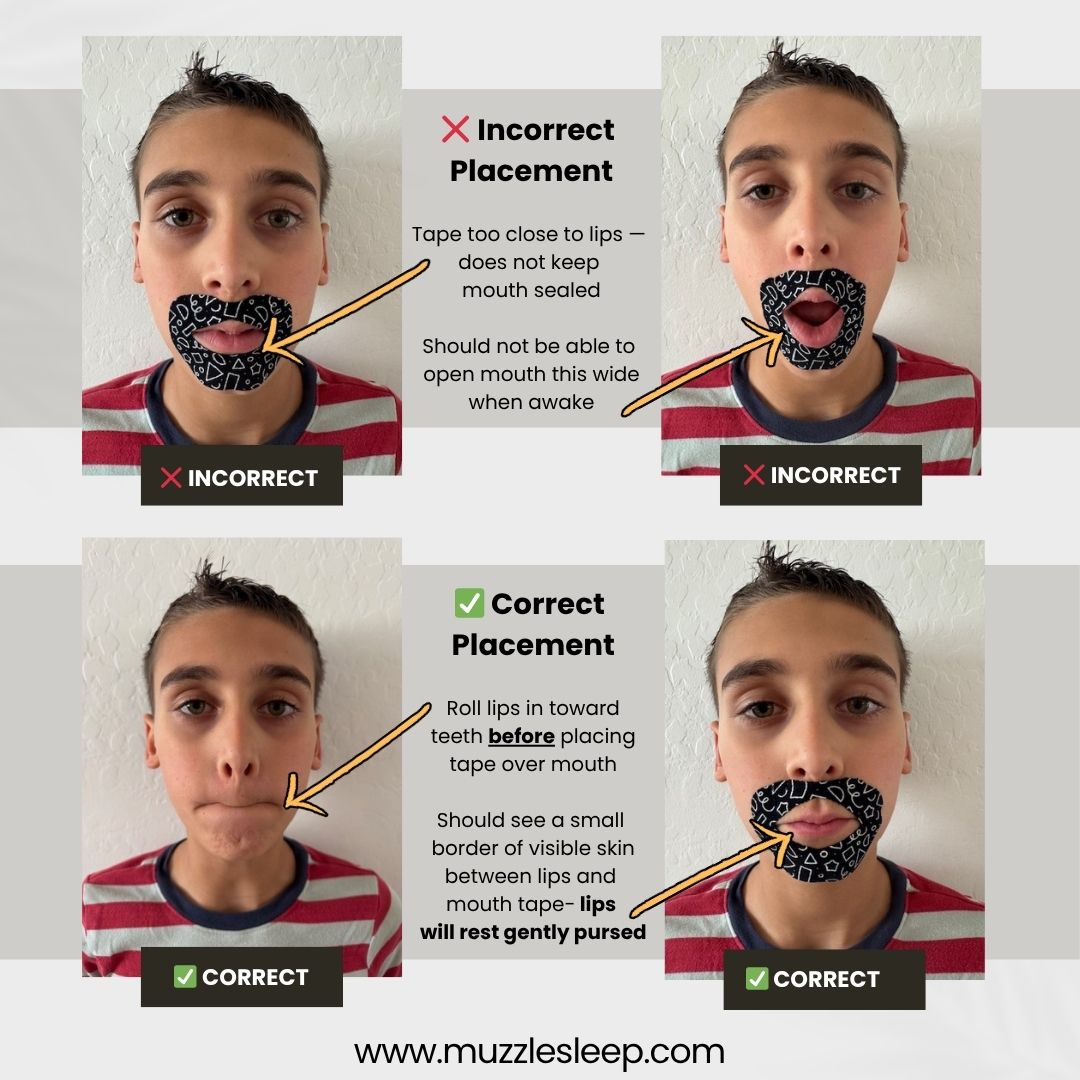 Muzzle® Mouth Tape For Youth (Medium Hold) - WONDERWALL