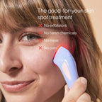 Bye Acne: 3-Minute Pimple Spot Treatment - WONDERWALL