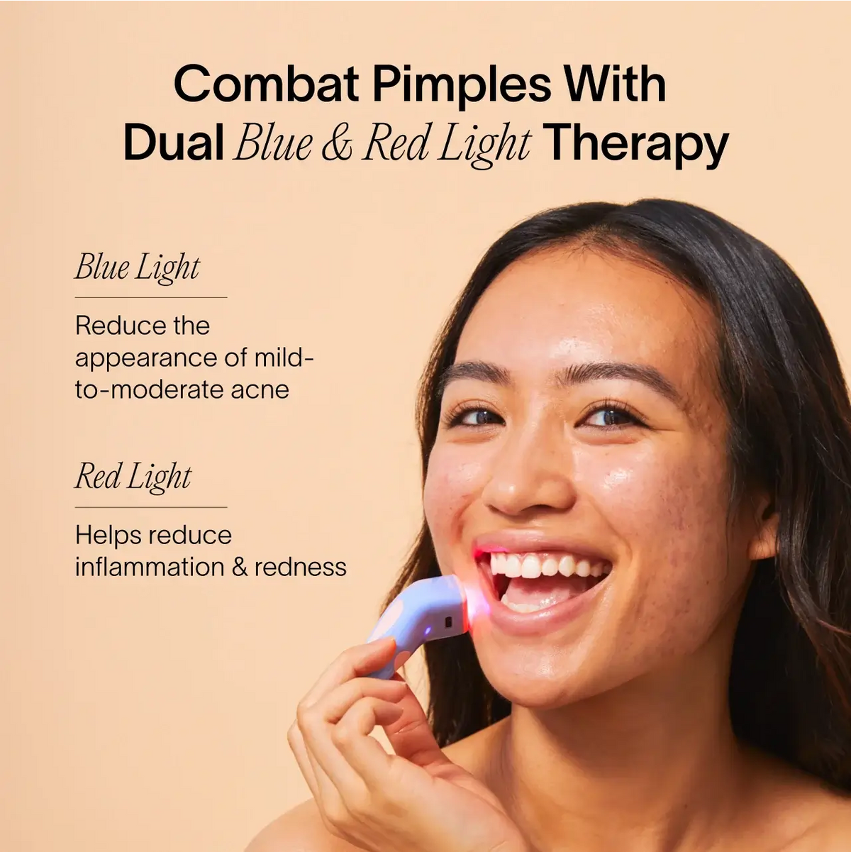 Bye Acne: 3-Minute Pimple Spot Treatment - WONDERWALL